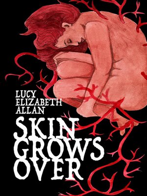 cover image of Skin Grows Over